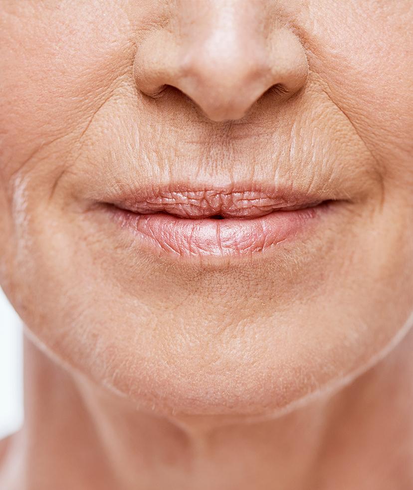 Understanding the Causes of Wrinkles for Better Prevention